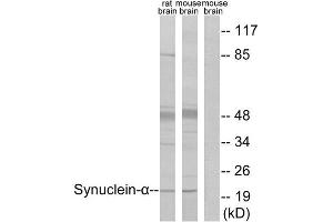 Western Blotting (WB) image for anti-Synuclein, alpha (SNCA) (Tyr125) antibody (ABIN1848159) (SNCA anticorps  (Tyr125))