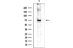anti-Acyl-CoA Synthetase Long-Chain Family Member 6 (ACSL6) (Internal Region) antibody