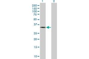 Western Blot analysis of WBSCR22 expression in transfected 293T cell line by WBSCR22 MaxPab polyclonal antibody. (WBSCR22 anticorps  (AA 1-281))