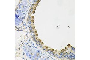 Immunohistochemistry of paraffin-embedded mouse lung using AIF1 antibody (ABIN5970719) at dilution of 1/100 (40x lens). (Iba1 anticorps)