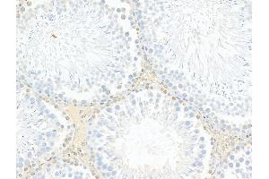 ABIN6263171 and ABIN6278338 at 1/100 staining Rat testis tissue by IHC-P. (MCRS1 anticorps  (N-Term))