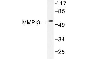Image no. 1 for anti-Matrix Metallopeptidase 3 (Stromelysin 1, Progelatinase) (MMP3) antibody (ABIN265531) (MMP3 anticorps)