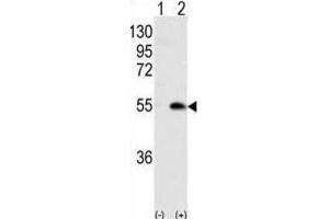 Western Blotting (WB) image for anti-Calcium/calmodulin-Dependent Protein Kinase IG (CAMK1G) antibody (ABIN3003081) (CAMK1G anticorps)