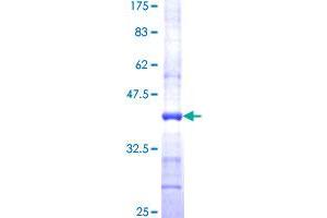Image no. 1 for Fatty Acid Amide Hydrolase (FAAH) (AA 480-579) protein (GST tag) (ABIN1353335)