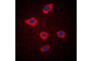 Immunofluorescent analysis of Mammaglobin A staining in MCF7 cells. (Mammaglobin A anticorps  (Center))