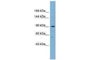 Western Blot showing E2F8 antibody used at a concentration of 1-2 ug/ml to detect its target protein. (E2F8 anticorps  (Middle Region))