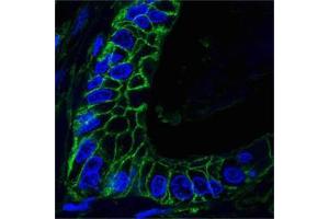 Confocal analysis of paraffin-embedded human lung cancer tissues using CD44 antibody (green), showing membrane localization. (CD44 anticorps)