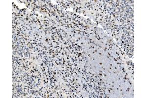 IHC analysis of JUNB using anti-JUNB antibody (ABIN7603223). (JunB anticorps  (N-Term))
