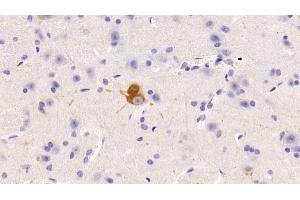 Detection of NOS1 in Mouse Spinal cord Tissue using Polyclonal Antibody to Nitric Oxide Synthase 1, Neuronal (NOS1)