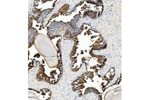 IHC analysis of ANPEP using anti-ANPEP antibody (ABIN7600087). (CD13 anticorps  (AA 148-966))