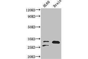 Western Blot Positive WB detected in: HL60 whole cell lysate, Mouse brain tissue All lanes: TPI1 antibody at 2 μg/mL Secondary Goat polyclonal to rabbit IgG at 1/50000 dilution Predicted band size: 31, 27, 18 kDa Observed band size: 31, 27 kDa (TPI1 anticorps  (AA 169-228))