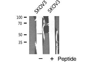 Western blot analysis of Cyclin A1 expression in SKOV3 cell extract (Cyclin A1 anticorps)