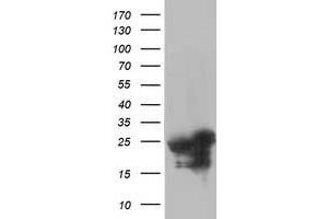 Western Blotting (WB) image for anti-Adenylate Kinase 4 (AK4) antibody (ABIN1496529) (AK4 anticorps)
