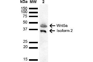 Western blot analysis of Human Cervical cancer cell line (HeLa) lysate showing detection of ~42. (WNT5A anticorps  (AA 200-300) (FITC))