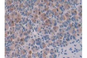 DAB staining on IHC-P; Samples: Mouse Stomach Tissue (Importin 8 anticorps  (AA 417-622))