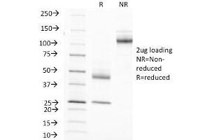 SDS-PAGE Analysis of Purified, BSA-Free EMA Antibody (clone MUC1/845). (MUC1 anticorps)
