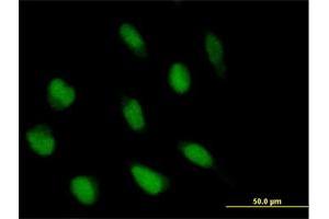 Immunofluorescence of purified MaxPab antibody to ABI2 on HeLa cell. (ABI2 anticorps  (AA 1-475))