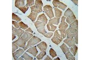Immunohistochemistry analysis in human skeletal muscle (Formalin-fixed, Paraffin-embedded) using Metaxin-2 Antibody (C-term), followed by peroxidase conjugated secondary antibody and DAB staining.