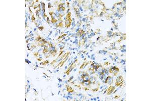 Immunohistochemistry of paraffin-embedded mouse lung using V antibody (ABIN6130774, ABIN6150046, ABIN6150047 and ABIN6224821) at dilution of 1:100 (40x lens). (VAMP1 anticorps  (AA 1-96))