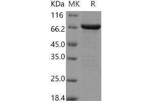Western Blotting (WB) image for Fibroblast Growth Factor Receptor 2 (FGFR2) (AA 400-821) (Active) protein (GST tag,His tag) (ABIN7317082)