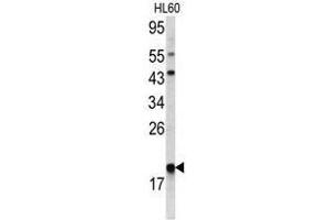 Image no. 1 for anti-Actin Related Protein 2/3 Complex, Subunit 3, 21kDa (ARPC3) (C-Term) antibody (ABIN452763) (ARPC3 anticorps  (C-Term))