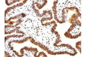 Image no. 3 for anti-Small Ubiquitin Related Modifier Protein 1 (SUMO1) antibody (ABIN6186913) (SUMO1 anticorps)