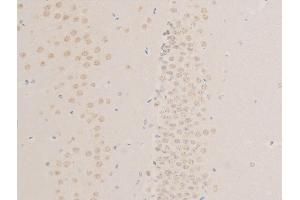 ABIN6267268 at 1/100 staining mouse brain tissue sections by IHC-P. (EGFR anticorps  (pSer1026))