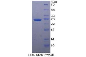 SDS-PAGE analysis of Human PK Protein. (PKLR Protéine)