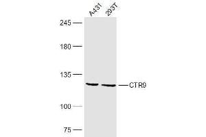Lane 1: A431 lysates Lane 2: 293T lysates probed with CTR9 Polyclonal Antibody, Unconjugated  at 1:300 dilution and 4˚C overnight incubation. (CTR9 anticorps  (AA 751-850))