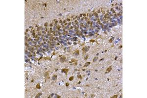Immunohistochemistry of paraffin-embedded rat brain using CPEB3 Rabbit pAb (ABIN7266666) at dilution of 1:300 (40x lens). (CPEB3 anticorps  (AA 150-400))