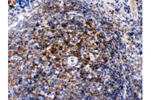 Immunohistochemistry (Paraffin-embedded Sections) (IHC (p)) image for anti-Actin, alpha 1, Skeletal Muscle (ACTA1) (AA 277-308), (C-Term) antibody (ABIN3043519)
