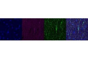 Immunohistochemistry (IHC) image for anti-ATP Synthase, H+ Transporting, Mitochondrial F1 Complex, alpha Subunit 1, Cardiac Muscle (ATP5A1) antibody (ABIN7456225)