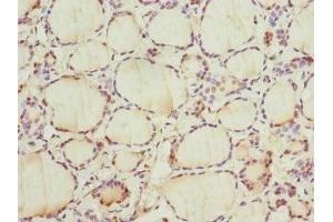 Immunohistochemistry of paraffin-embedded human thyroid tissue using ABIN7153399 at dilution of 1:100