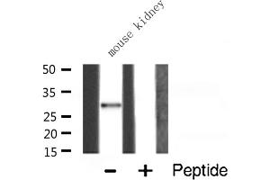 Western blot analysis of RPS4X expression in Mouse kidney lysate (RPS4X anticorps  (Internal Region))
