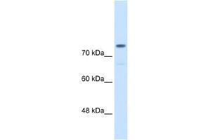 Alpha Actinin 4 antibody used at 0. (alpha Actinin 4 anticorps  (C-Term))