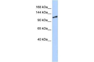 WB Suggested Antibody Titration: 0. (SMARCA1 anticorps  (N-Term))