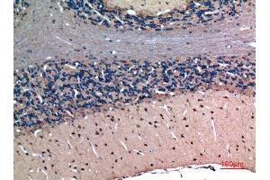 Immunohistochemistry (IHC) analysis of paraffin-embedded Rat Brain, antibody was diluted at 1:100.