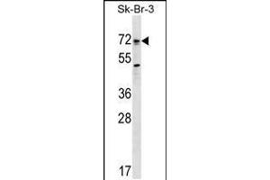 Western blot analysis in SK-BR-3 cell line lysates (35ug/lane). (BMPR1A anticorps  (AA 170-197))