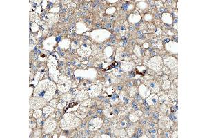 IHC analysis of Kindlin 2/FERMT2 using anti-Kindlin 2/FERMT2 antibody (ABIN7599515). (FERMT2 anticorps  (AA 1-650))