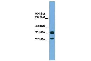 Western Blot showing CD8B antibody used at a concentration of 1-2 ug/ml to detect its target protein. (CD8B anticorps  (Middle Region))