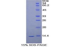 SDS-PAGE analysis of Human VEGFD Protein. (VEGFD Protéine)