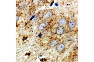 Immunohistochemistry (IHC) image for anti-Ribosomal Protein S10 (RPS10) antibody (ABIN7308290)