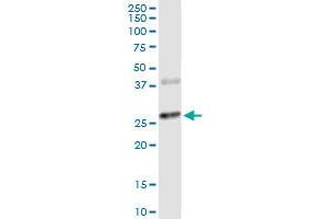 CTLA4 monoclonal antibody (M06), clone 2F1. (CTLA4 anticorps  (AA 36-135))