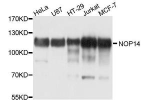 Western blot analysis of extracts of various cell lines, using NOP14 antibody. (Nop14 anticorps  (AA 1-240))