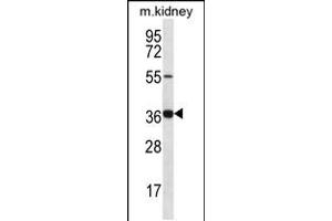 Western blot analysis in mouse kidney tissue lysates (35ug/lane). (GRXCR1 anticorps  (AA 83-112))