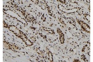 ABIN6266020 and ABIN6273186 at 1/100 staining Human kidney tissue by IHC-P. (WDR46 anticorps  (Internal Region))