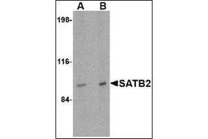 Western blot analysis of SATB2 in mouse brain tissue lysate with this product at (A) 2 and (B) 4 μg/ml. (SATB2 anticorps  (N-Term))