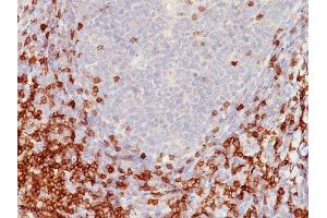 Formalin-fixed, paraffin-embedded human Tonsil stained with CD5 Mouse Monoclonal Antibody (C5/473). (CD5 anticorps)