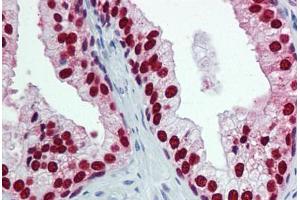 Human Prostate: Formalin-Fixed, Paraffin-Embedded (FFPE)