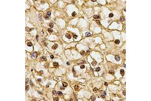 Immunohistochemical analysis of CSN1 staining in human kidney formalin fixed paraffin embedded tissue section.